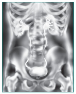 IVP x-ray of kidneys, ureters, and bladder