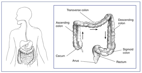 Anatomic Problems of the Lower GI Tract | NIDDK