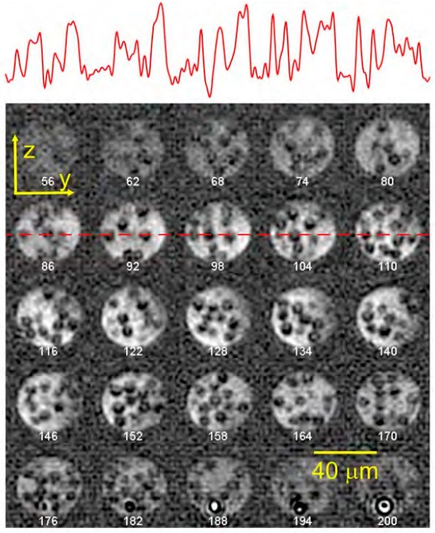 Low-temperature magnetic resonance imaging with 1.7 micron isotropic resolution, a current world's record.