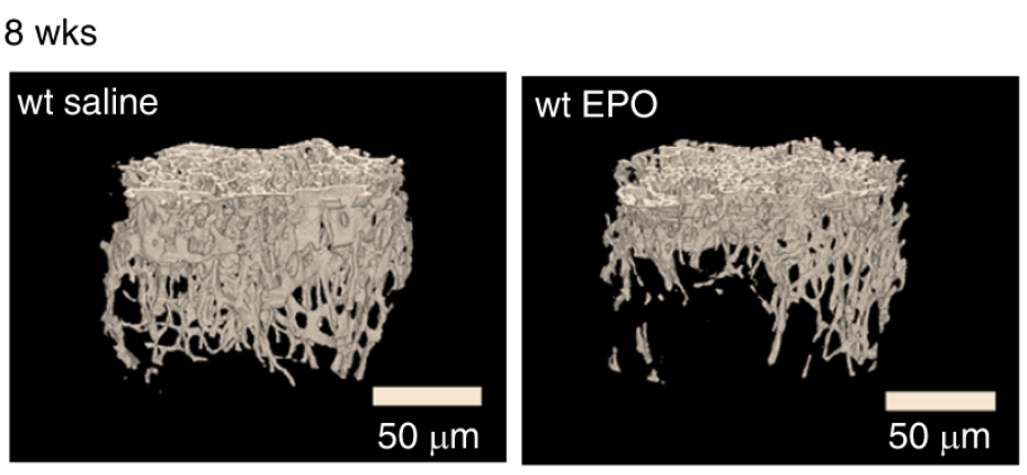 Picture of Erythropoietin treatment, which promotes bone loss in mice