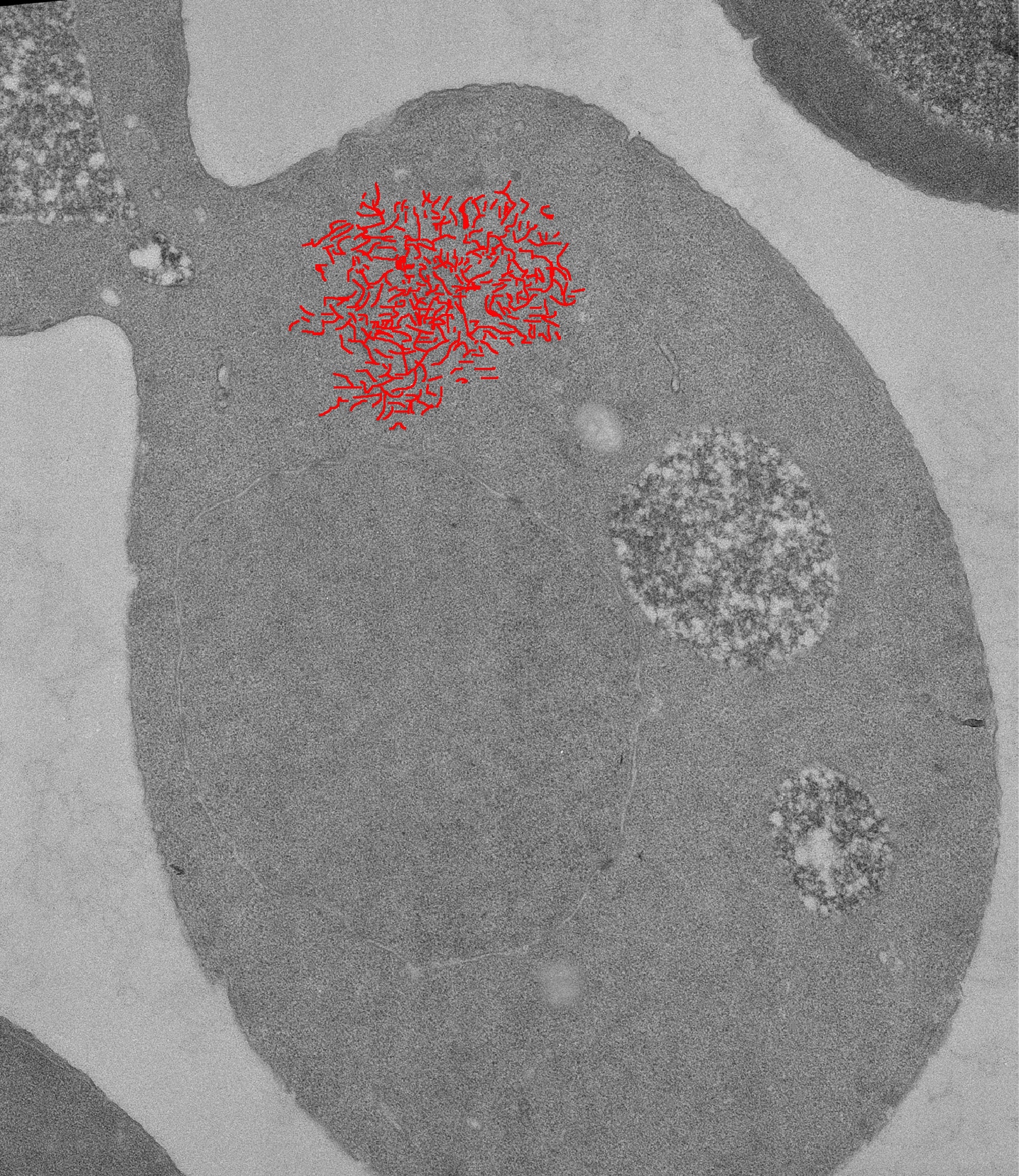 Filaments of Ure2 protein in a URE3 prison cell.