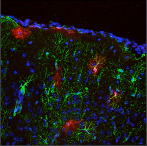 Type 2 deiodinase, a thyroid hormone-generating enzyme, in glial cells (red) in the cerebral cortex