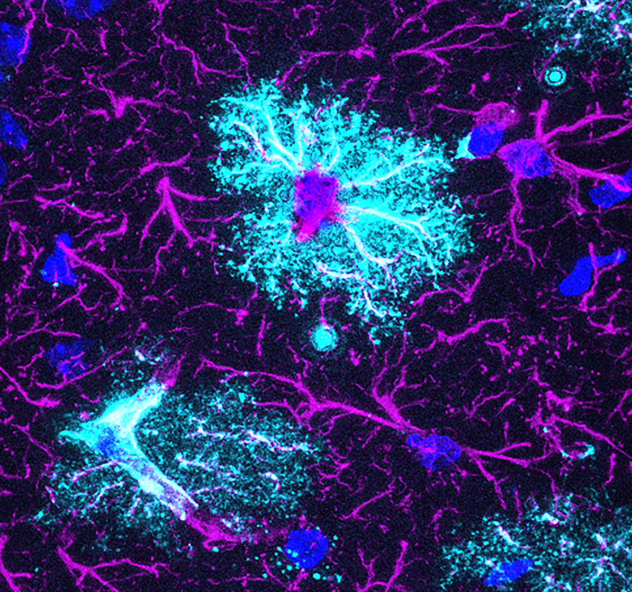 Astrocyte in the brain expressing DIO2 deiodinase, an enzyme that amplifies the thyroid hormone signal for nearby target neurons.