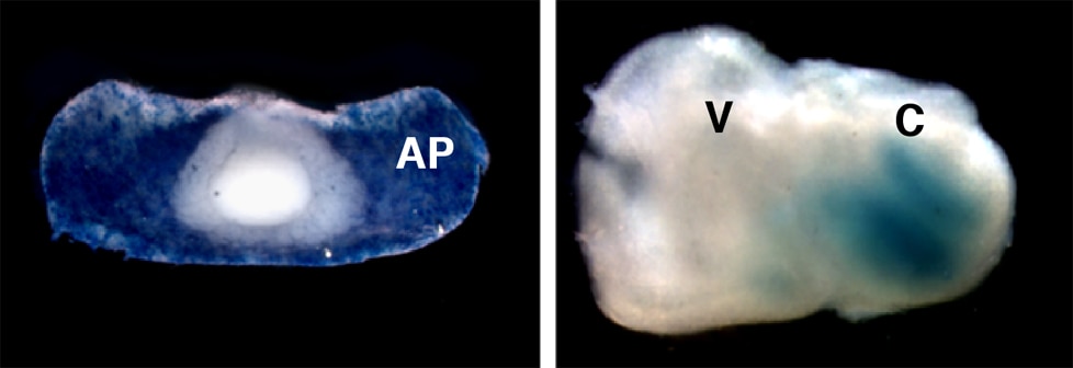 Expression of the THRB thyroid hormone receptor gene in the anterior pituitary gland (left) and inner ear (right)