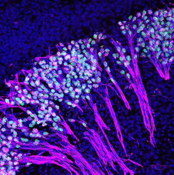 Thyroid hormone controls the development of hearing. Spiral ganglion neurons in the cochlea relay signals elicited by sound to the brain.  These neurons express DIO3, a thyroid hormone-depleting enzyme, that regulates the degree of exposure to thyroid hormone.