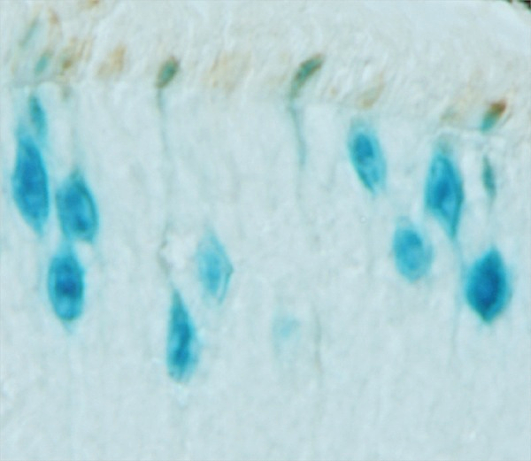 Thyroid hormone and retinal development.