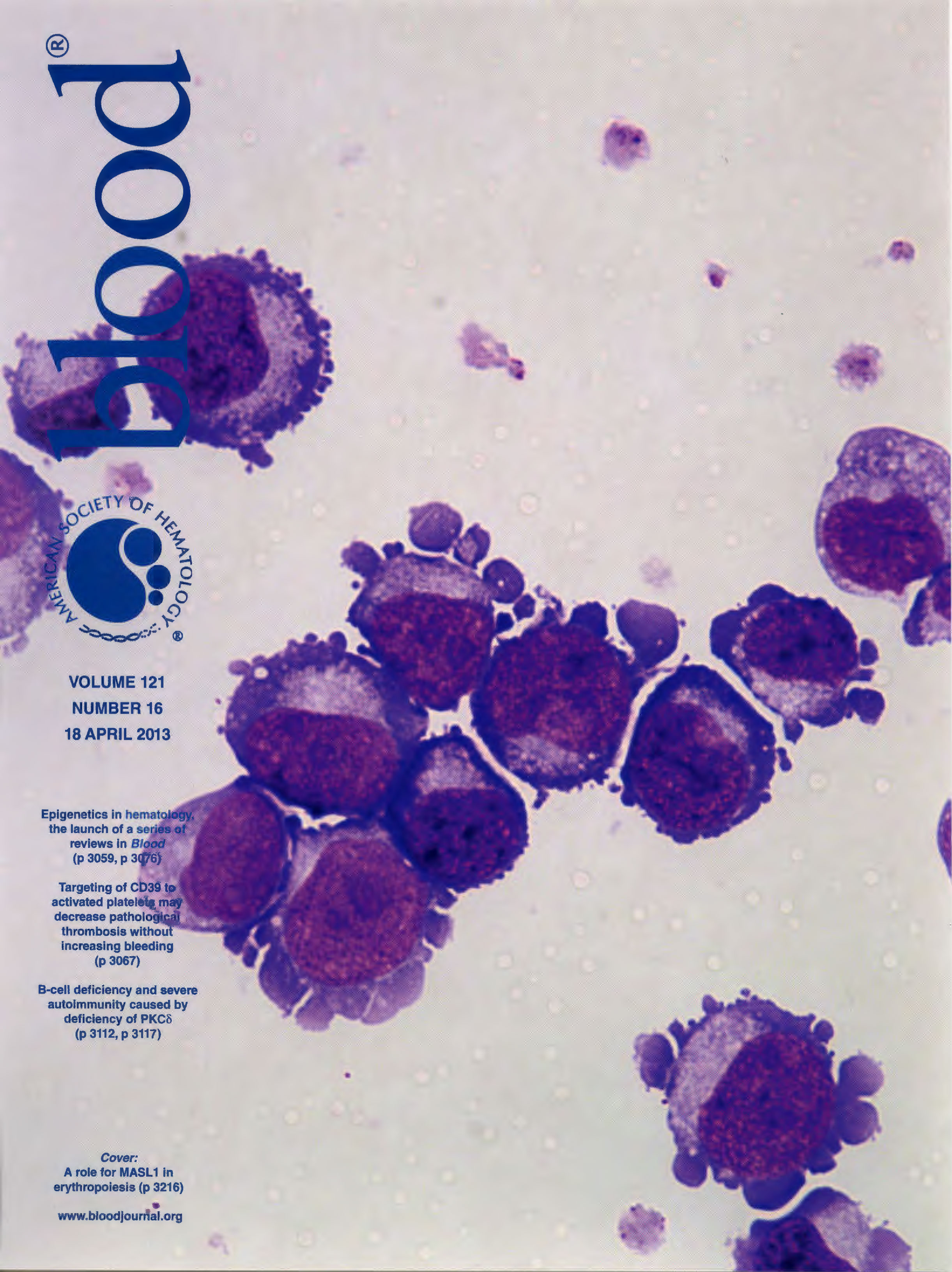 Photo of Cover of Blood, April 2013