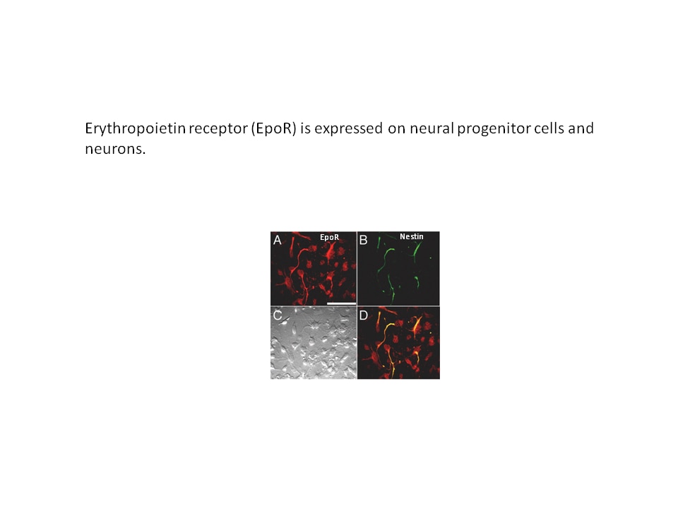 Photo of Erythropoietin receptor expression in neural cells