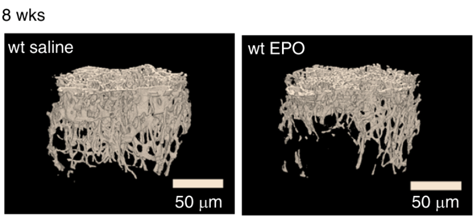 Erythropoietin treatment.