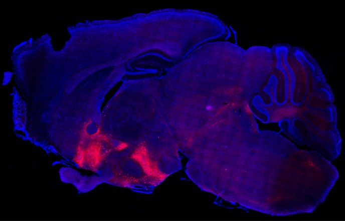 Slide of BRS3 expressing neurons found in selected nuclei in the brain.