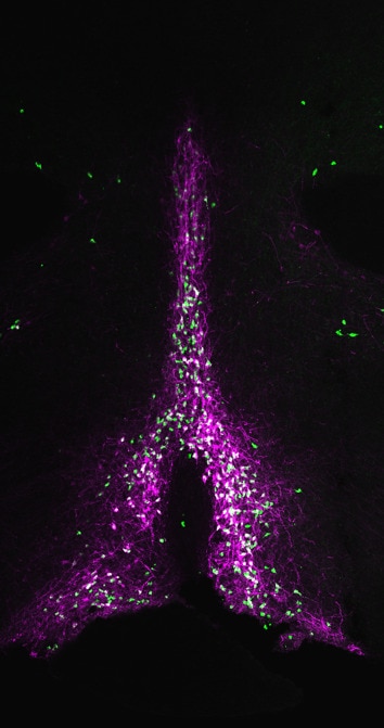 Slide of preoptic area BRS3 neurons expressing hM4Di-mCherry.