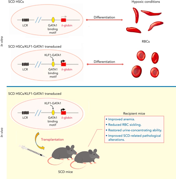 Process showing Kruppel-like factor 1–GATA1 fusion protein improving the sickle cell disease phenotype in mice both in vitro and in vivo. 