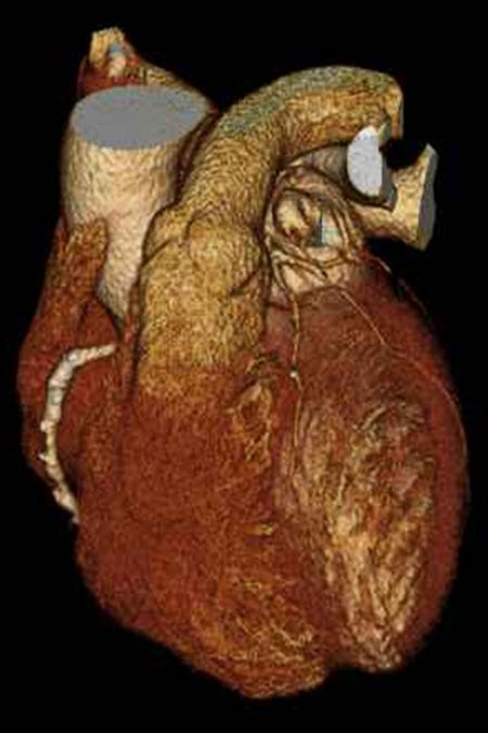 Image of a heart