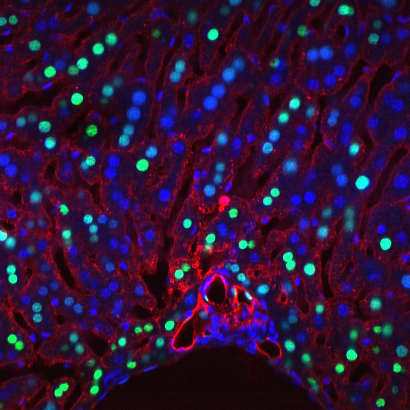 Photo showing cells that have undergone sphingosine-1-phosphate receptor 1 activation (green nuclei) in this liver section from SIP1 GFP reporter mice.