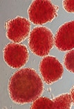 Photo of Human Islets