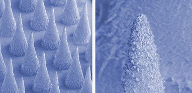 Photo of scanning electron micrographs of the microneedle array and microneedle tip.