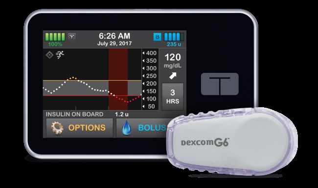 Continuous glucose monitor and insulin pump