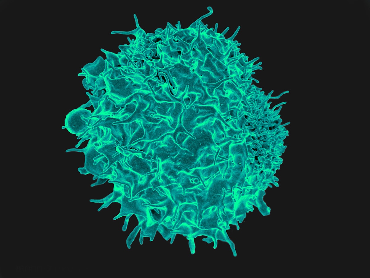 Colorized scanning electron micrograph of a T lymphocyte