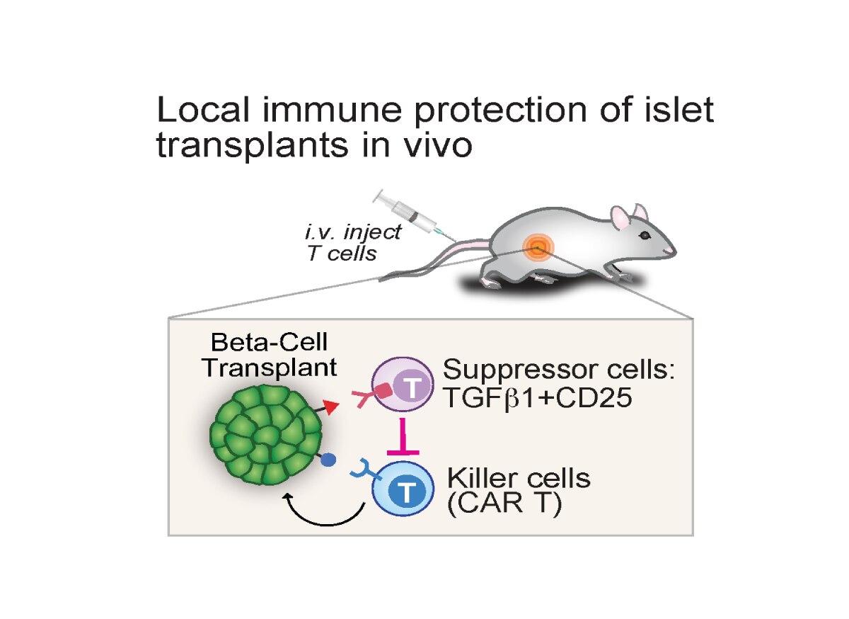 Local immune protection of islet transplants in vivo. A mouse undergoing a pancreatic beta-cell transplant where T cells are injected by I.V.. Immune suppressor cells, known as TGFβ1+CD25, are blocking the killer cells, known as CAR T cells, which destroy infected and damaged cells in the body.