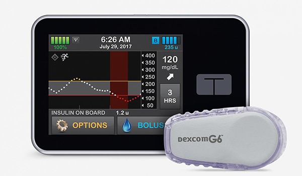 Artificial pancreas system