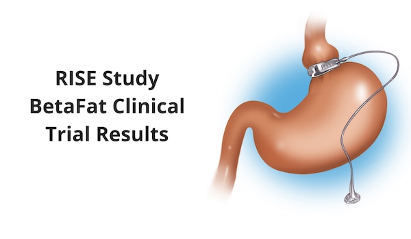 Gastric Banding Illustration