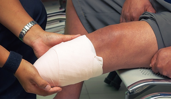 A doctor checking a persons leg amputation.