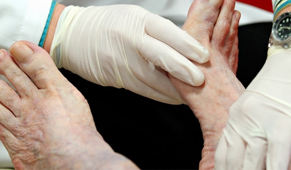 A doctor examining a patient's feet.