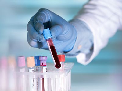 Lab technician holding a blood tube sample.