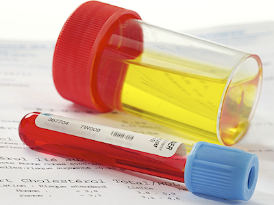 Blood and urine test viles.