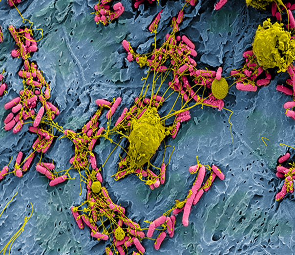 E coli bacteria