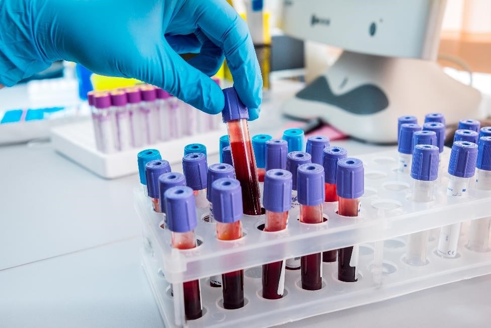 Tubes of blood rest in a rack on a lab table.