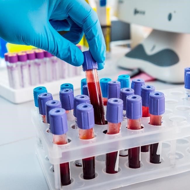 Tubes of blood rest in a rack on a lab table.