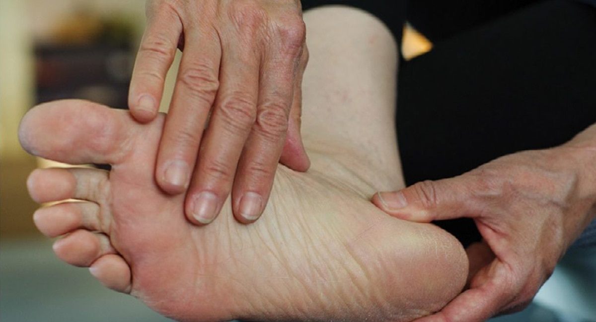 How Diabetes Impacts the Feet? - Diabetic Foot Problems