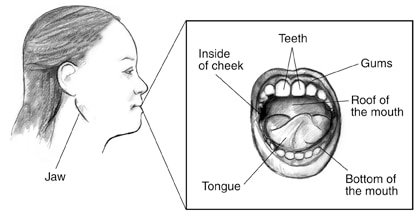 Drawing of a woman’s facial profile with the jaw labeled. Inset shows teeth, gums, roof of the mouth, bottom of the mouth, tongue, and inside of cheek. 