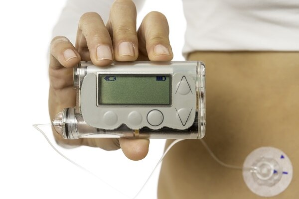 Photo of a woman holding an insulin pump with the tube connected to a patch on her stomach, where the needle is inserted.