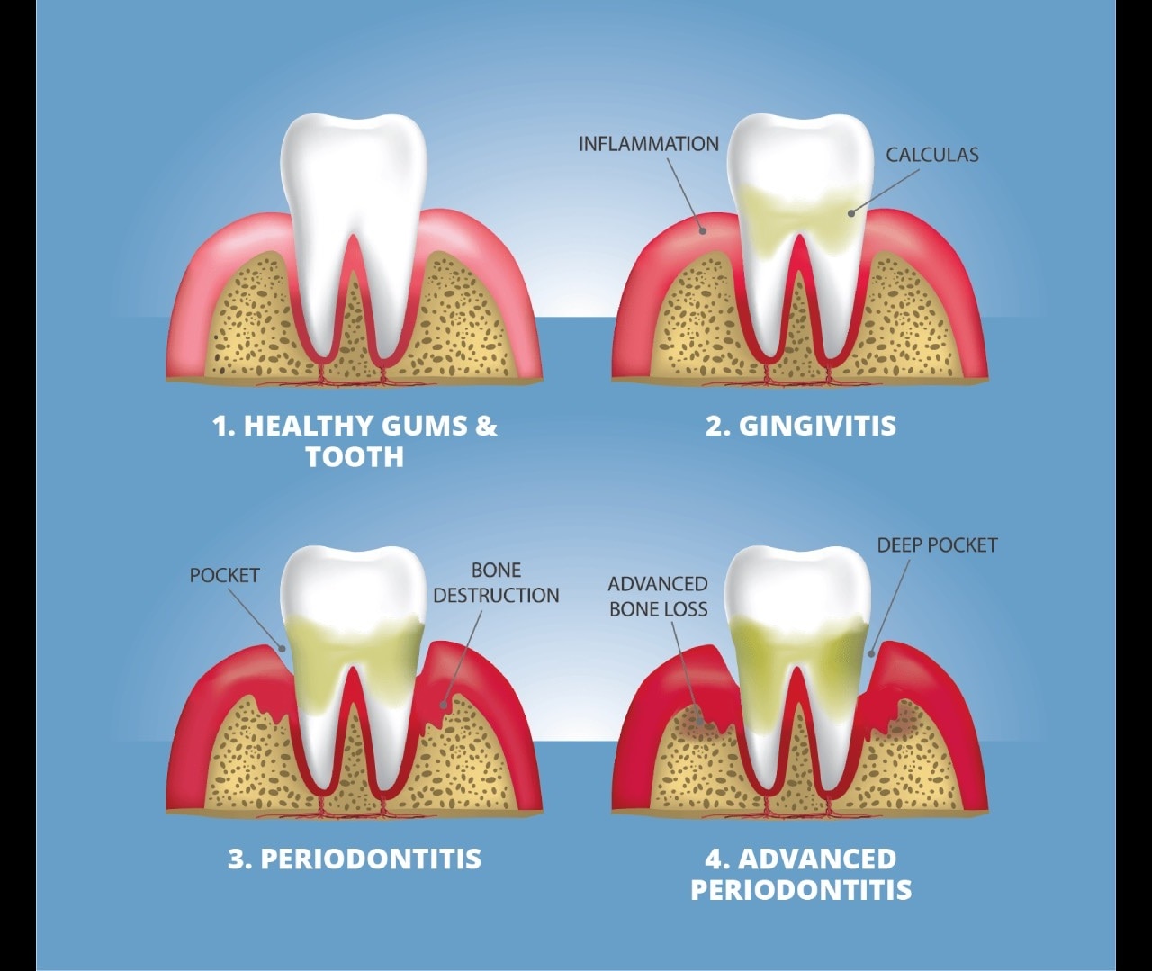 types of oral diseases