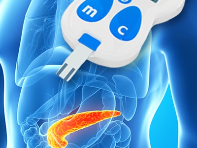 A diagram of the pancreas inside the body and a blood glucose meter.
