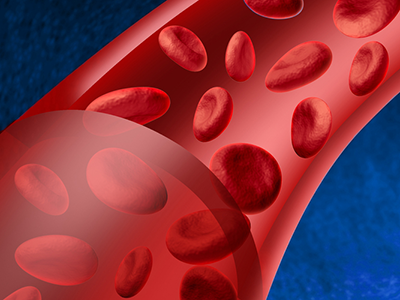 Blood disease organ diagram