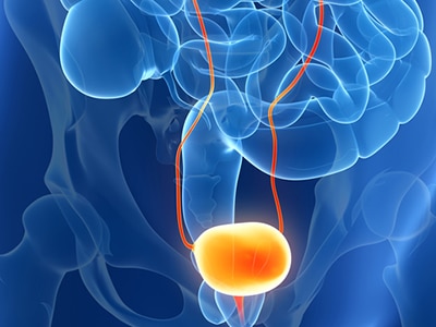 Urologic Diseases | NIDDK