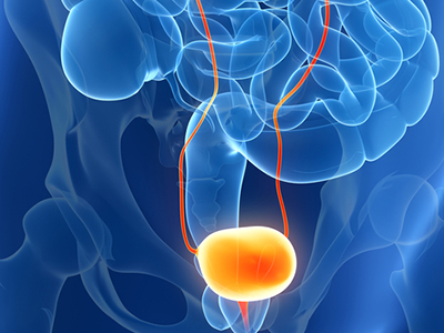 Urological disease organ diagram