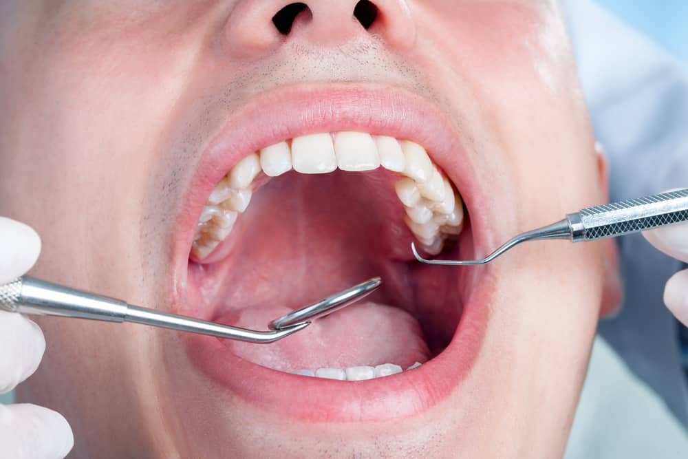 A person getting a dental cleaning with dental tools inserted into an open mouth.