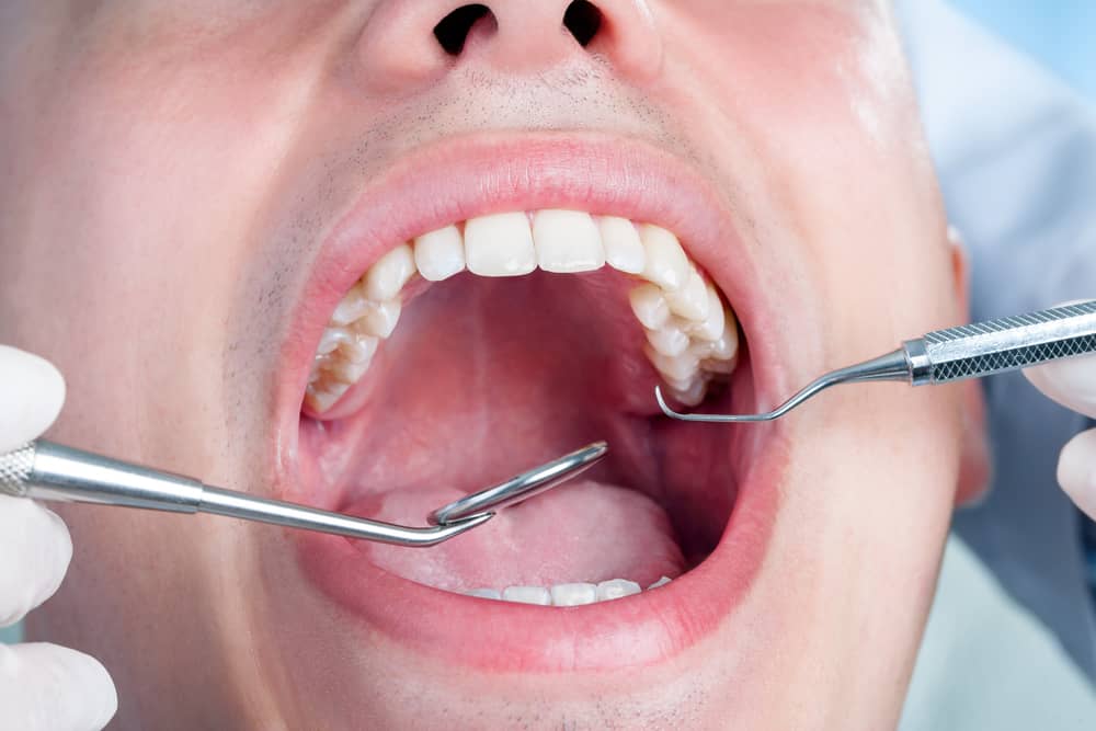 Teeth Cleaning And Teeth Whitening In Seattle, Wa