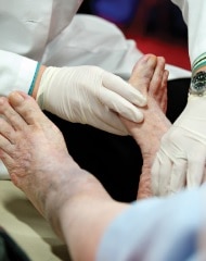 Photo of a doctor examining someone’s bare feet.