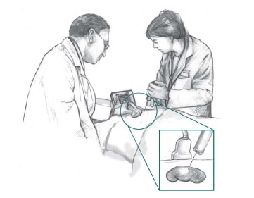 باستخدام تقنيات التصوير ، يقوم اثنان من أخصائيين الرعاية الصحية بإدخال إبرة خزعة في مؤخرة مريض يرقد على منضدة. تُظهر الصورة الداخلية دخول الإبرة إلى الكلية.