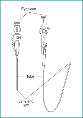 Drawing of a rigid cystoscope and a flexible ureteroscope with eyepieces, tubes, and lenses and lights labeled.