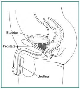 رسم منظر جانبي للمسالك البولية الذكرية مع وضع علامة على المثانة والبروستاتا والإحليل.