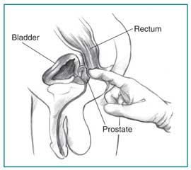 urine test for prostate problems)