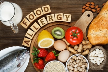 Various foods that may cause food allergies.