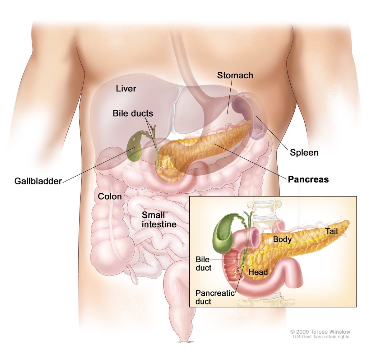 Illustration showing the size and location of the pancreas in the body. An inset provides a closer view of the pancreas, showing the duct that carries digestive juice to the small intestine. Labels indicate the liver, stomach, bile ducts, gallbladder, spleen, colon, small intestine, pancreas, pancreatic duct, and the head, body, and tail of the pancreas.