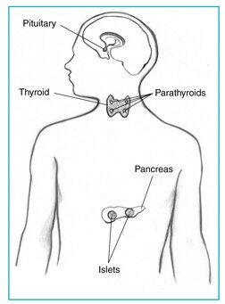 Image result for men 1 syndrome